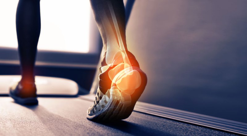 https://www.muscleandfitness.com/wp-content/uploads/2017/07/1109-heel-bones-tendons-pain.jpg?w=800&quality=86&strip=all