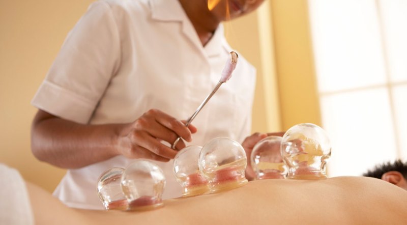 6 Things to Know About Cupping Therapy - Muscle & Fitness