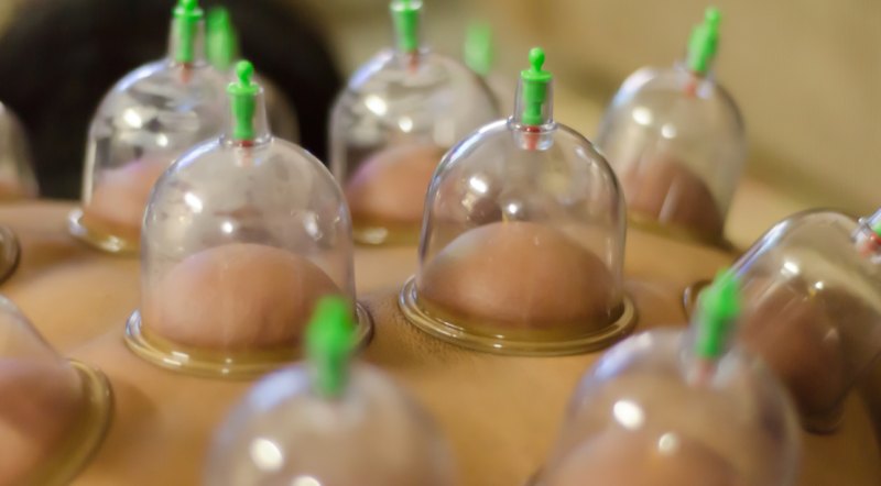 6 Things to Know About Cupping Therapy - Muscle & Fitness