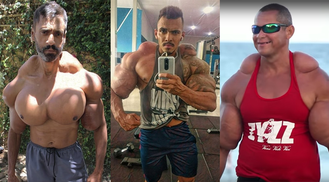 7 Alleged 'Synthol Freaks' Who Went too Far - Muscle & Fitness