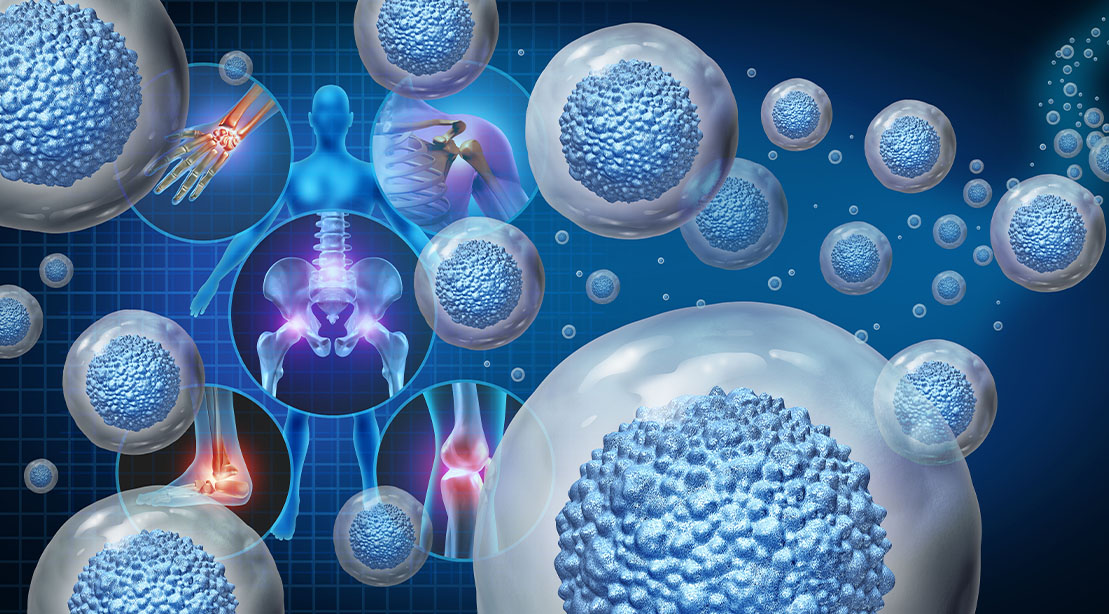 Stem Cells for Athletes: Revolutionize Performance & Healing